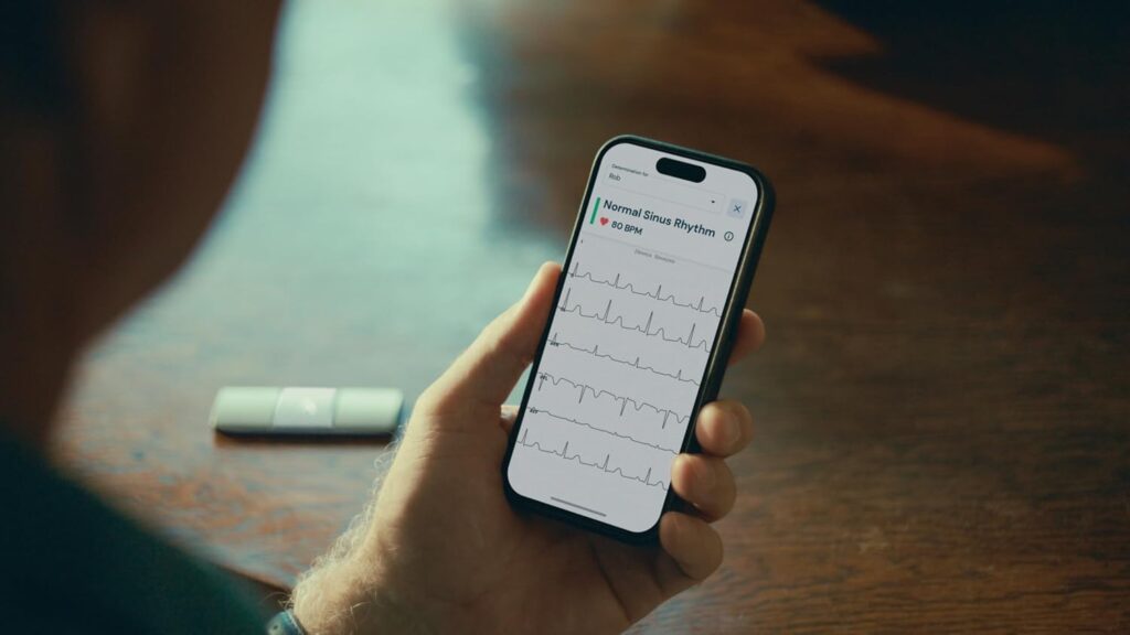 ecg home monitor
